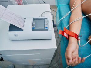 EKG on a human arm